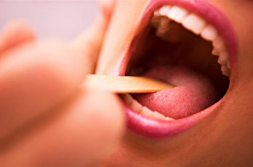 Az emberi szájban található paraziták típusai